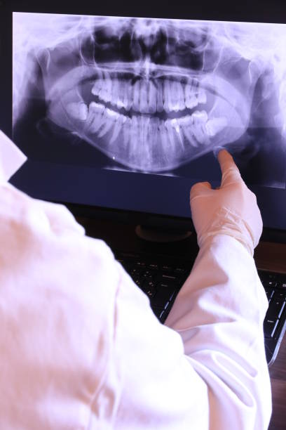 Best Tooth Infection Emergency Dentist  in Monte Vista, CO