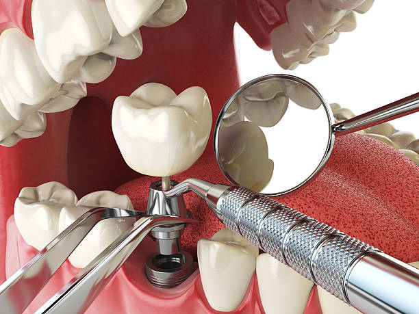 Best Cracked Tooth Emergency Dentist  in Monte Vista, CO